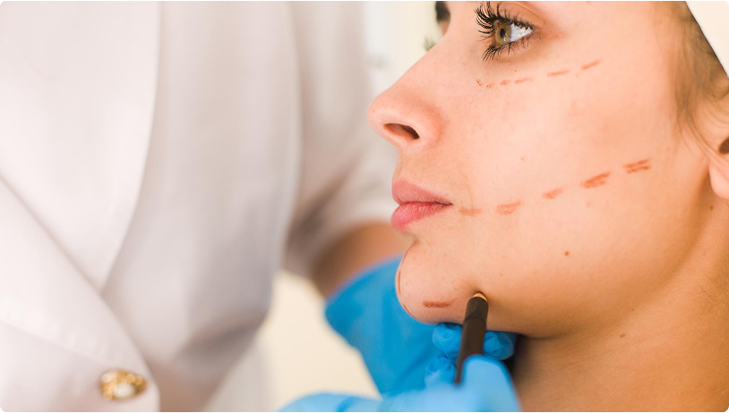 Facial surgery marking consultation